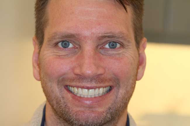 tænder efter behandling med Invisalign