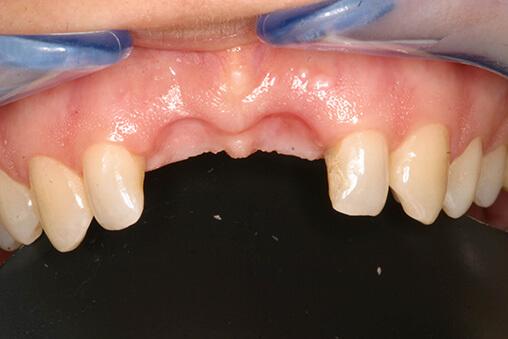 Before image