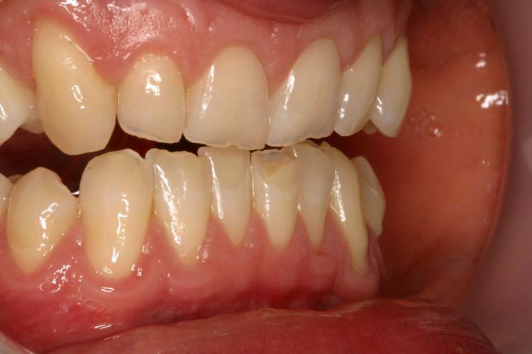 Before image