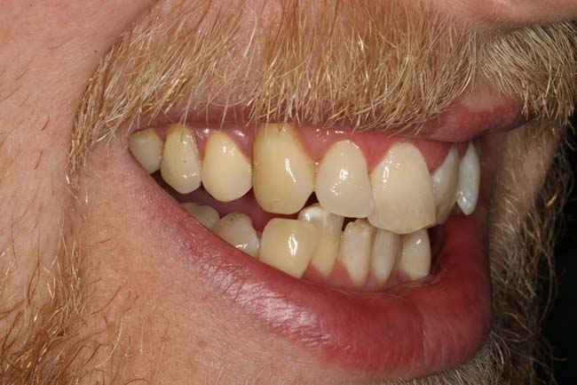 Before image