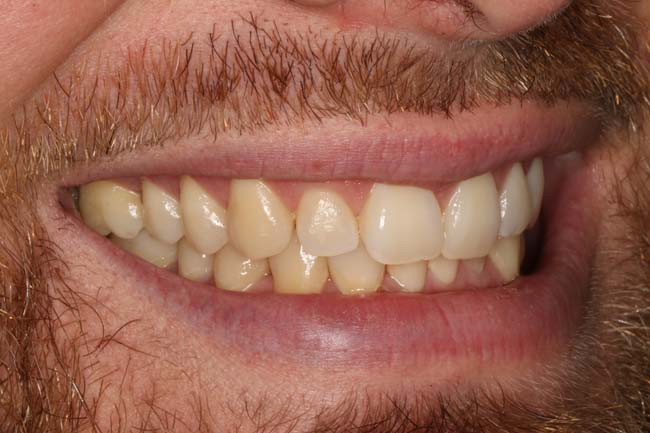 Before image