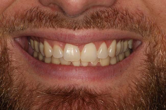 Before image