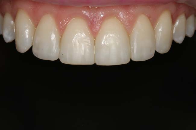 After image