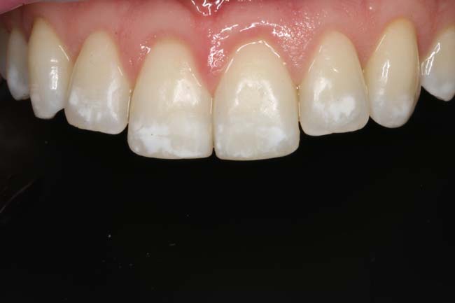 Before image