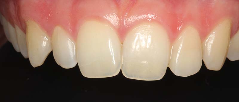 After image