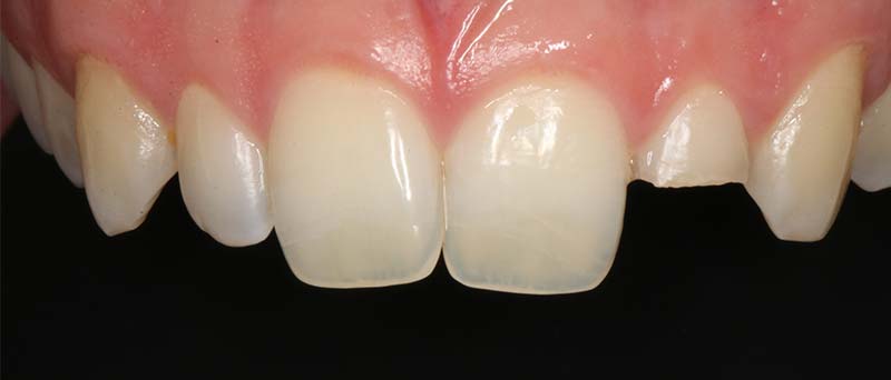 Before image