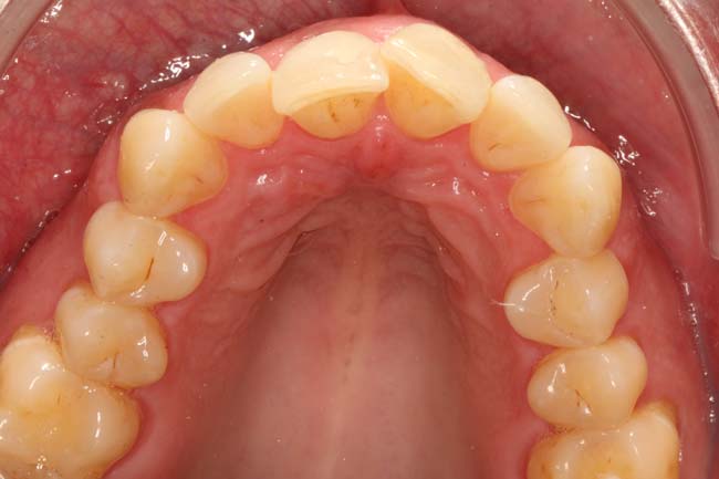 Before image