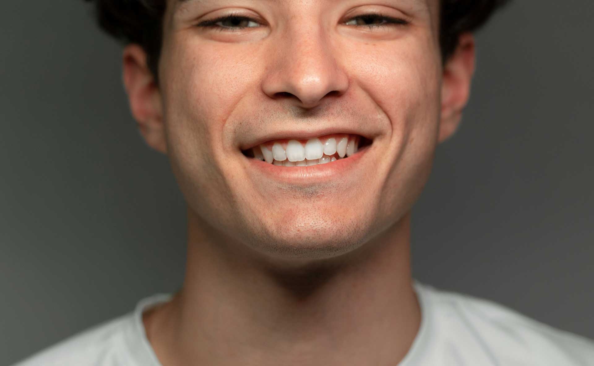 uregelmæssigheder i smil
