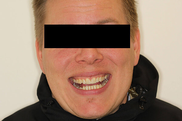 tænder efter